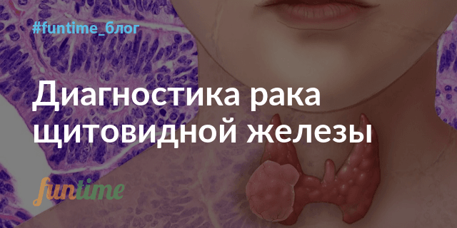 Папиллярный рак щитовидной железы прогноз после операции сколько лет жизни